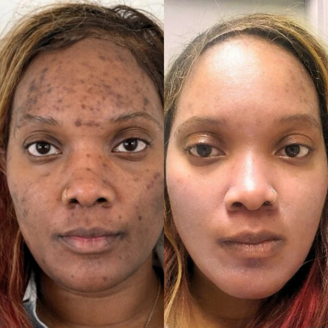 Bria, 37